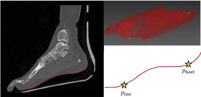 Figure 5. Extracted sole (red) and two feature points (yellow)
