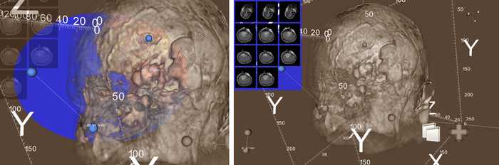 Figure 2. (Left) Measurement tool. (Right) 2D image viewer.