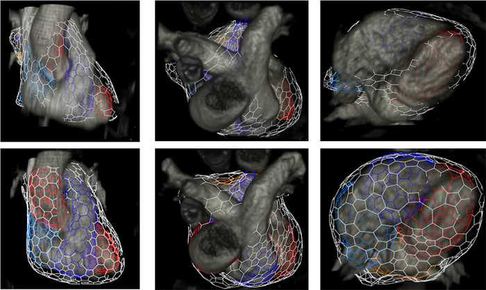 Figure 4. (Top) Results of volume rendering and the standard mesh model not deformed. (Bottom) Results of our segmentation framework.