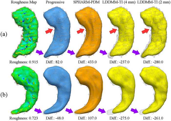 Figure 2. Example of hippocampal shape models of large volume differences to the input masks (Diff.: model volume – volume of input masks (mm^3))