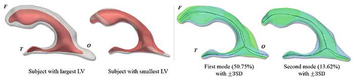 Figure 4. (Left) Ventricular surface meshes (white) of the largest and smallest size with the average surface mesh (red). (Right) Surface meshes with their skeletons representing the shape variation of the first and second modes between ±3 standard deviations (SD).