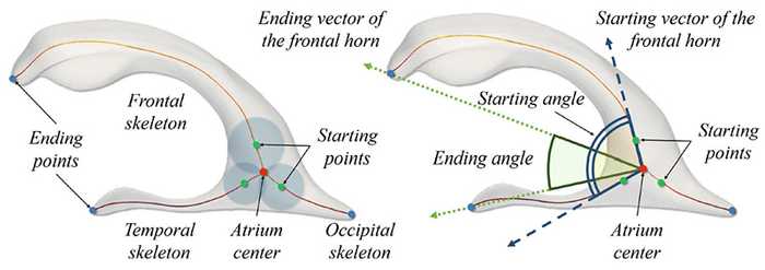 Figure 3. Ventricular shape model with its skeleton and landmarks